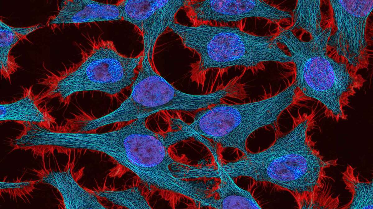 Bild aus dem Mikroskop, eingefärbte Zellen