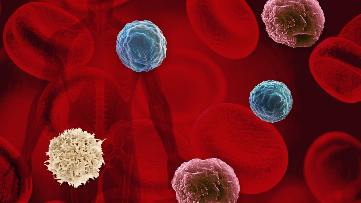 Bildcollage, rote Blutkörperchen und andere Zellen in verschiedenen Farben vor einem rot-schwarzen Hintergrund und der Röntgenbildsilhouette eines Menschen