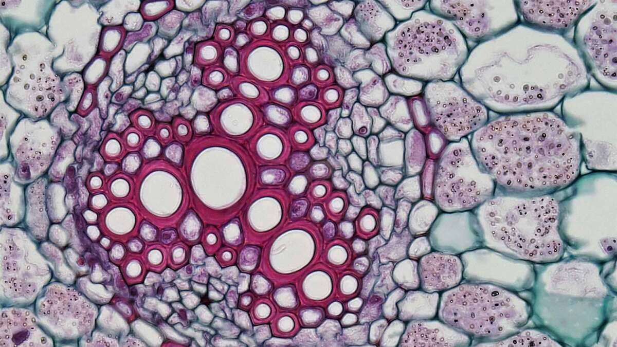 Bild von eingefärbten Zellen unterm Mikroskop