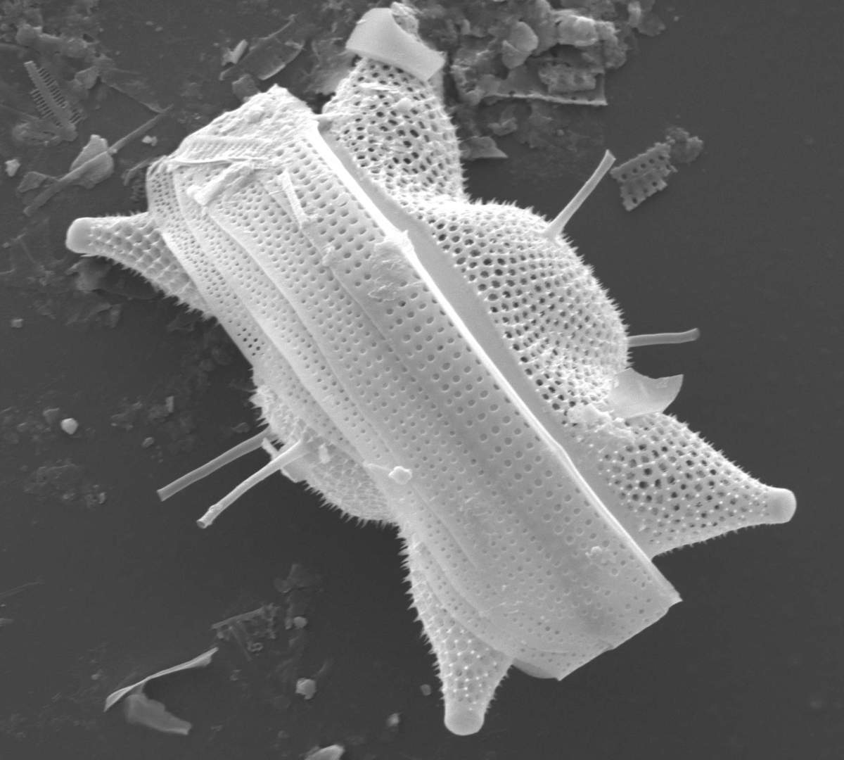 Eine Diatomeenschale im Elektronenmikroskopischen Bild