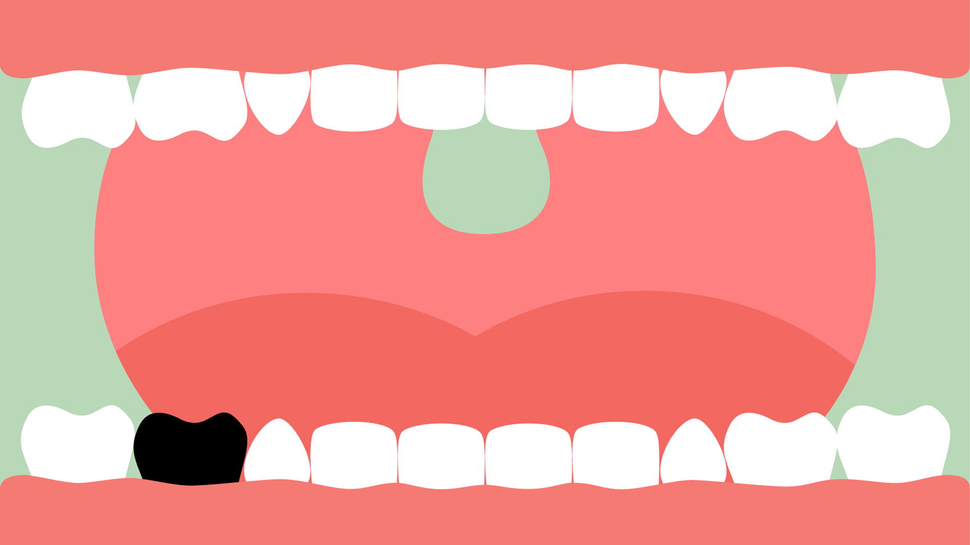 Grafik eines geöffneten Mundes