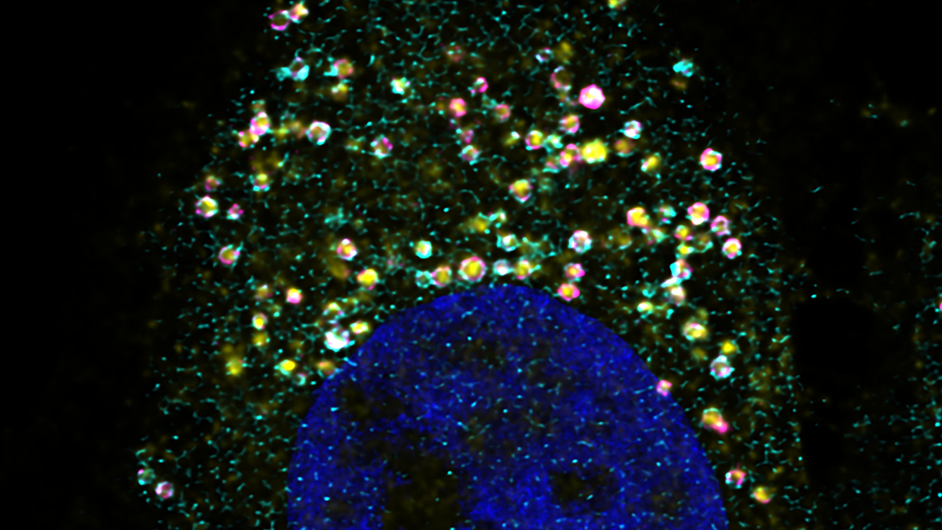Mikroskopische Aufnahme einer einzelnen Zellen mit hervorgehobenen Lysosomen