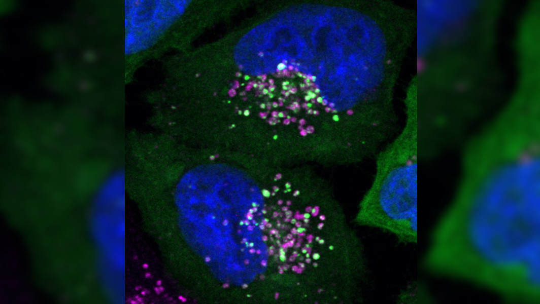 Konfokalmikoskopische Aufnahme zweier Zellen, bei denen Zellkern, Lysosomen und SPG20 in verschiedenen Farben dargestellt sind. Es ist zu erkennen, dass Lysosomen und SPG20 nach beieinander liegen.