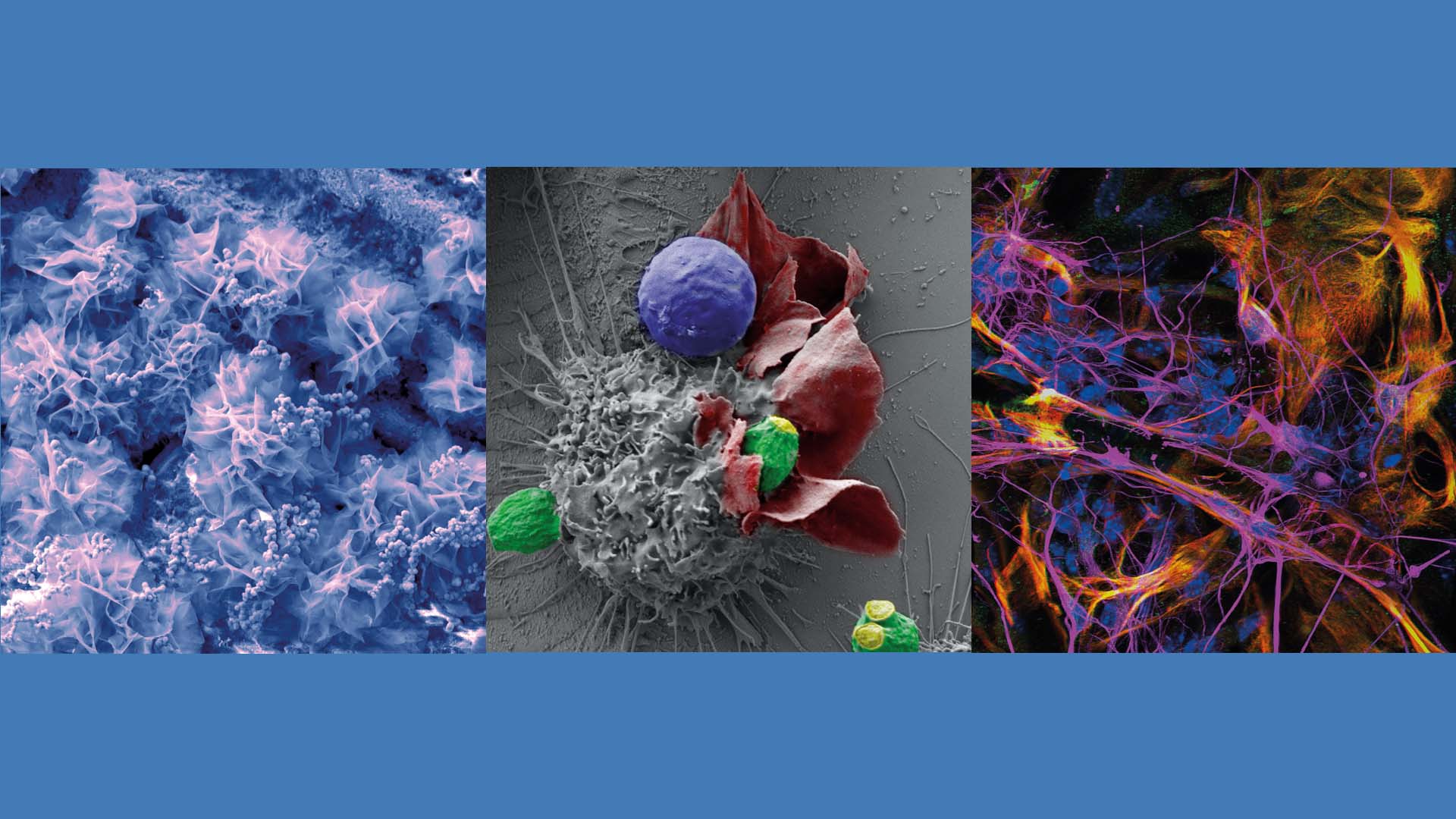 Fotomontage aus drei verschiedenen Mikroskop-Aufnahmen