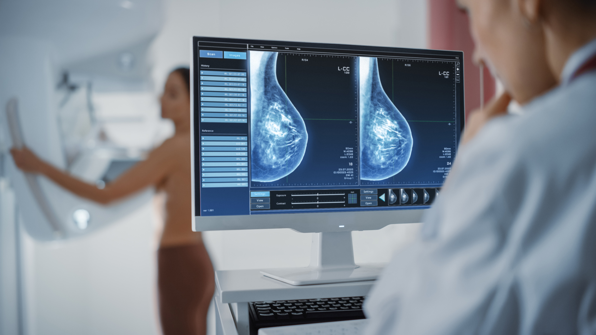 Mammographie-Bilder werden auf einem Monitor dagestellt 