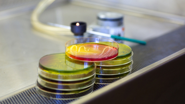 Foto von mehreren Petrischalen mit bunten Nährböden auf einem Labortisch
