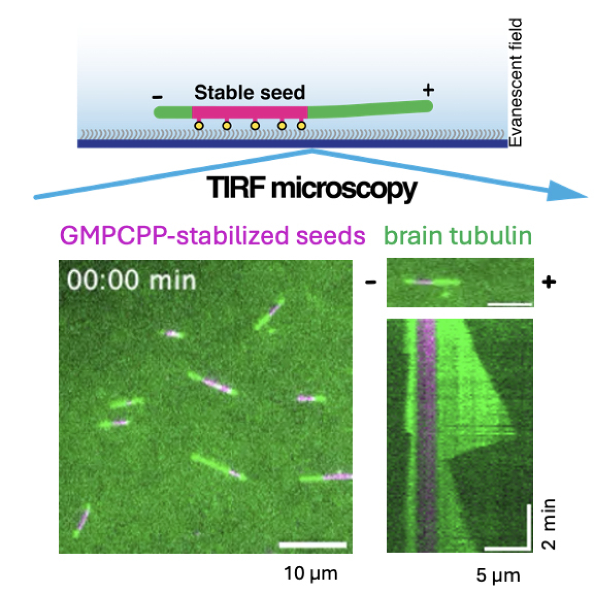 Graphic research illustration that explains the details of the regulation of microtubules by molecular motors and plus end-binding proteins.